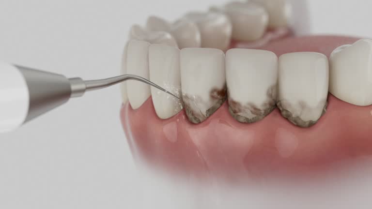 Reliable Dental Implants contractor in Perry Park, CO by Smile Center Dentistry